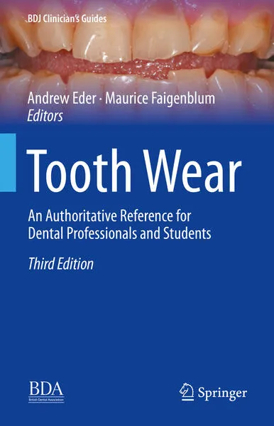 Cover: Tooth Wear