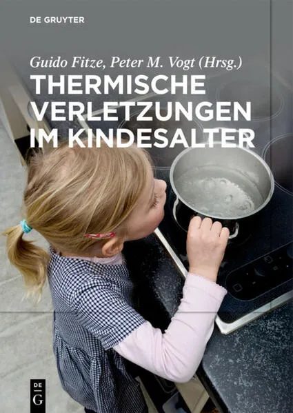 Cover: Thermische Verletzungen im Kindesalter