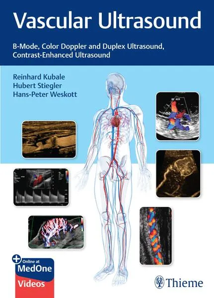 Cover: Vascular Ultrasound