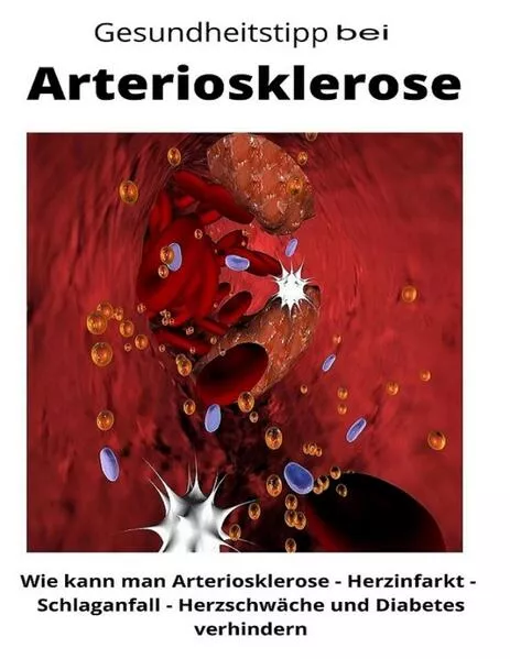 Gesundheitstipp bei Arteriosklerose</a>