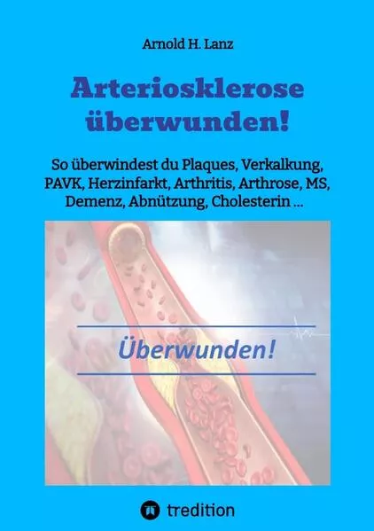 Cover: Arteriosklerose überwunden!