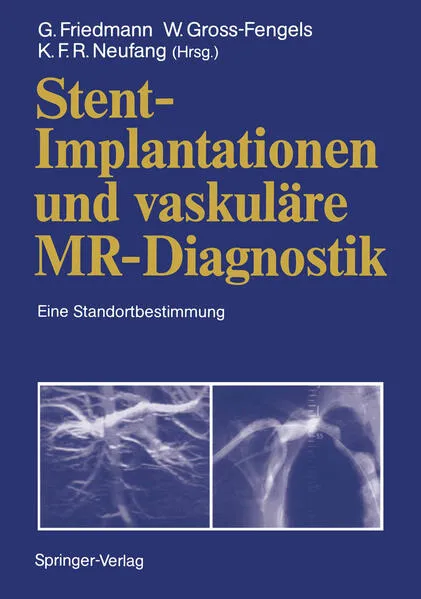 Stent-Implantationen und vaskulÀre MR-Diagnostik