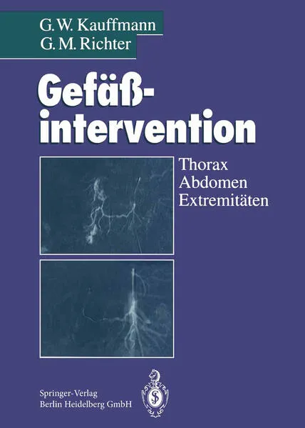 Gefäßintervention