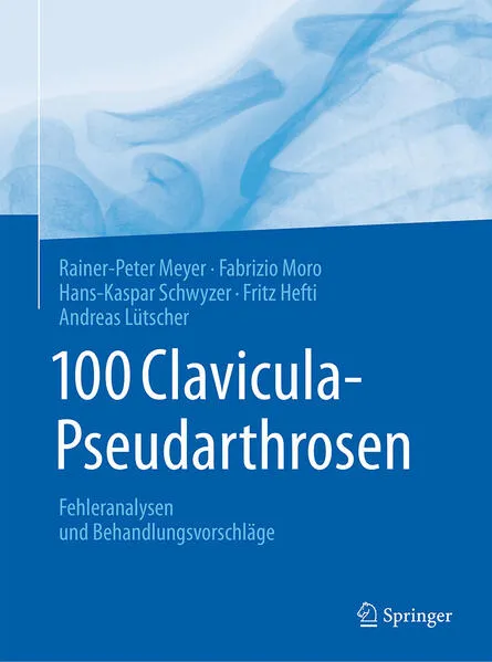 Cover: 100 Clavicula-Pseudarthrosen