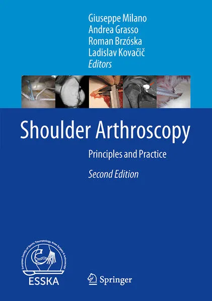 Cover: Shoulder Arthroscopy
