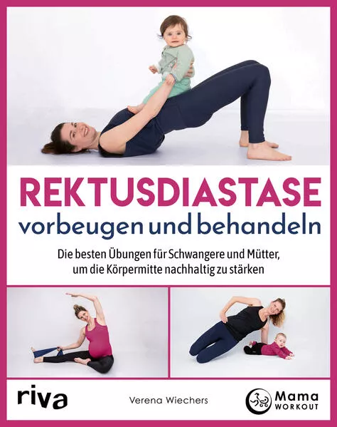 Cover: Rektusdiastase vorbeugen und behandeln