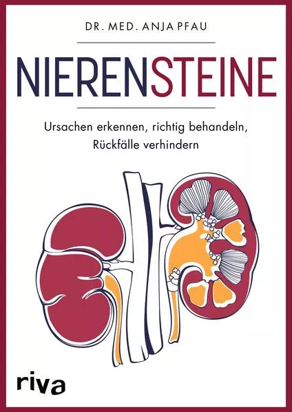 Cover: Nierensteine – Ursachen erkennen, richtig behandeln, Rückfälle verhindern