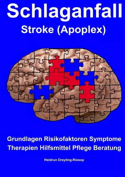 Cover: Schlaganfall Stroke (Apoplex)