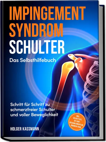 Cover: Impingement Syndrom Schulter - Das Selbsthilfebuch: Schritt für Schritt zu schmerzfreier Schulter und voller Beweglichkeit - inkl. Selbsttest, 30-Tage-Behandlungsplan, Übungen uvm.
