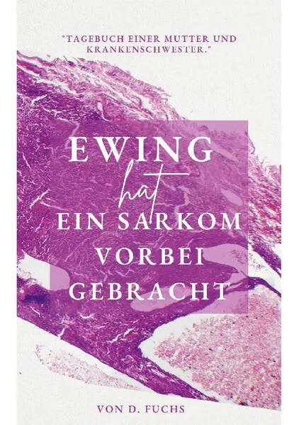Cover: Ewing hat ein Sarkom vorbeigebracht