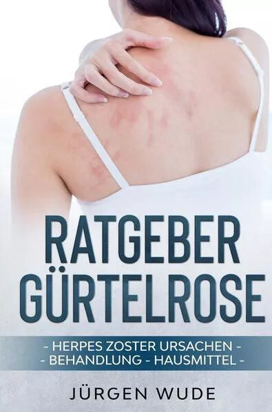Cover: Ratgeber Gürtelrose