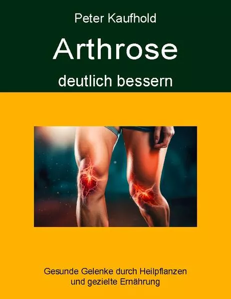 Cover: Arthrose deutlich bessern