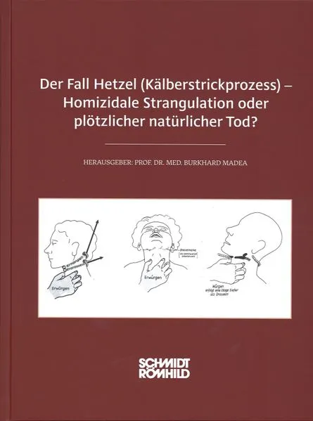 Cover: Der Fall Hetzel (Kälberstrickprozess) - Homizidale Strangulation oder plötzlicher natürlicher Tod?