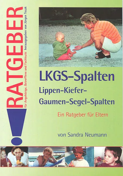 Cover: Lippen-Kiefer-Gaumen-Segel-Spalten (LKGS)