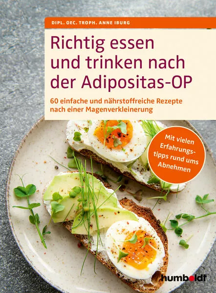 Cover: Richtig essen und trinken nach der Adipositas-OP