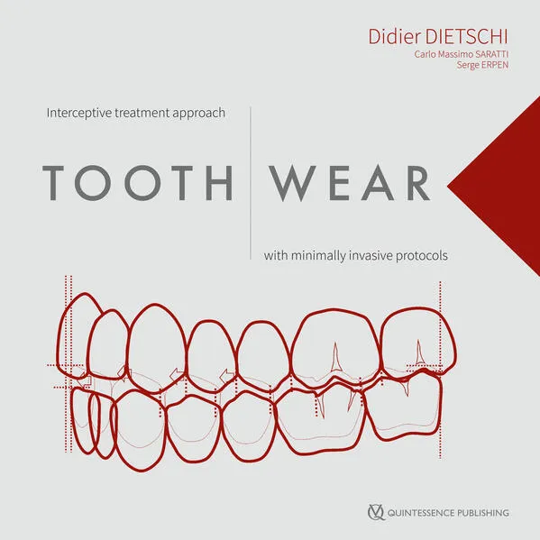Cover: Tooth Wear
