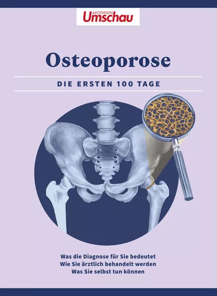 Cover: Apotheken Umschau: Osteoporose