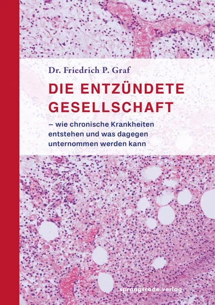 Cover: Die entzündete Gesellschaft