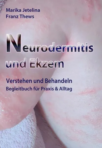Cover: Neurodermitis