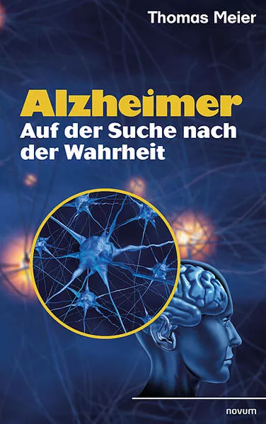 Cover: Alzheimer - Auf der Suche nach der Wahrheit